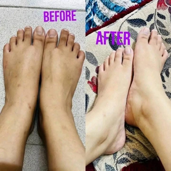 476369315_564020233459643_9179932323407662926_n-r1jne8ytaolw08ydpf1bx7bhxawgrbc4z3u5a1naxs